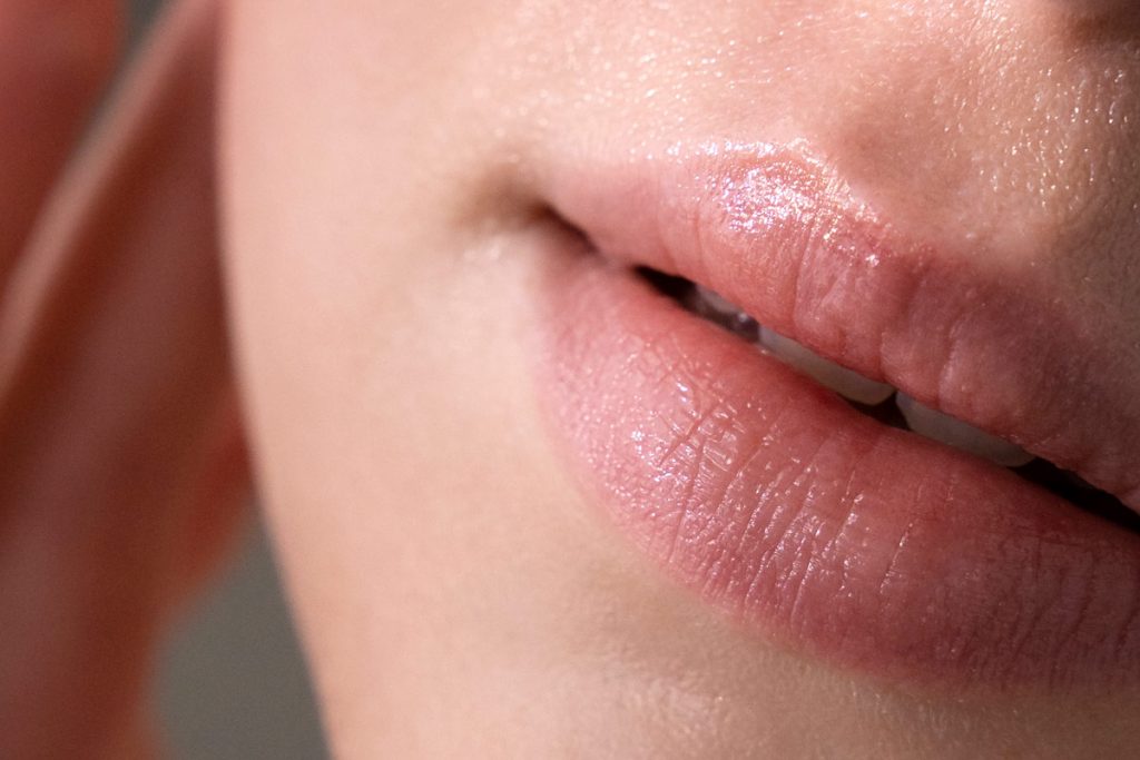 Hidratación de labios Liplase con fotona mujer
