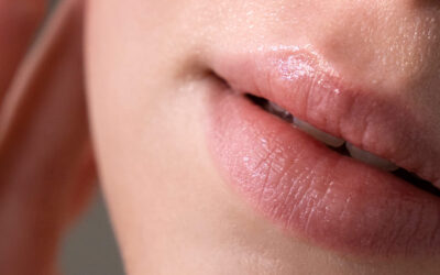 Hidratación de labios: cómo lograr unos labios jugosos sin agujas gracias al láser