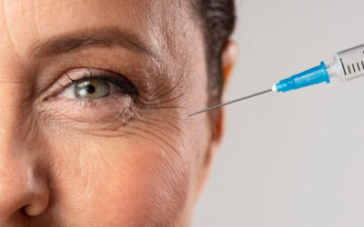 Cómo reducir las arrugas de expresión: tratamiento médico-estético eficaz y natural