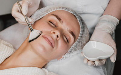 Peeling facial en Barcelona: tipos, beneficios, precios y cuidados con la Dra. Elmira