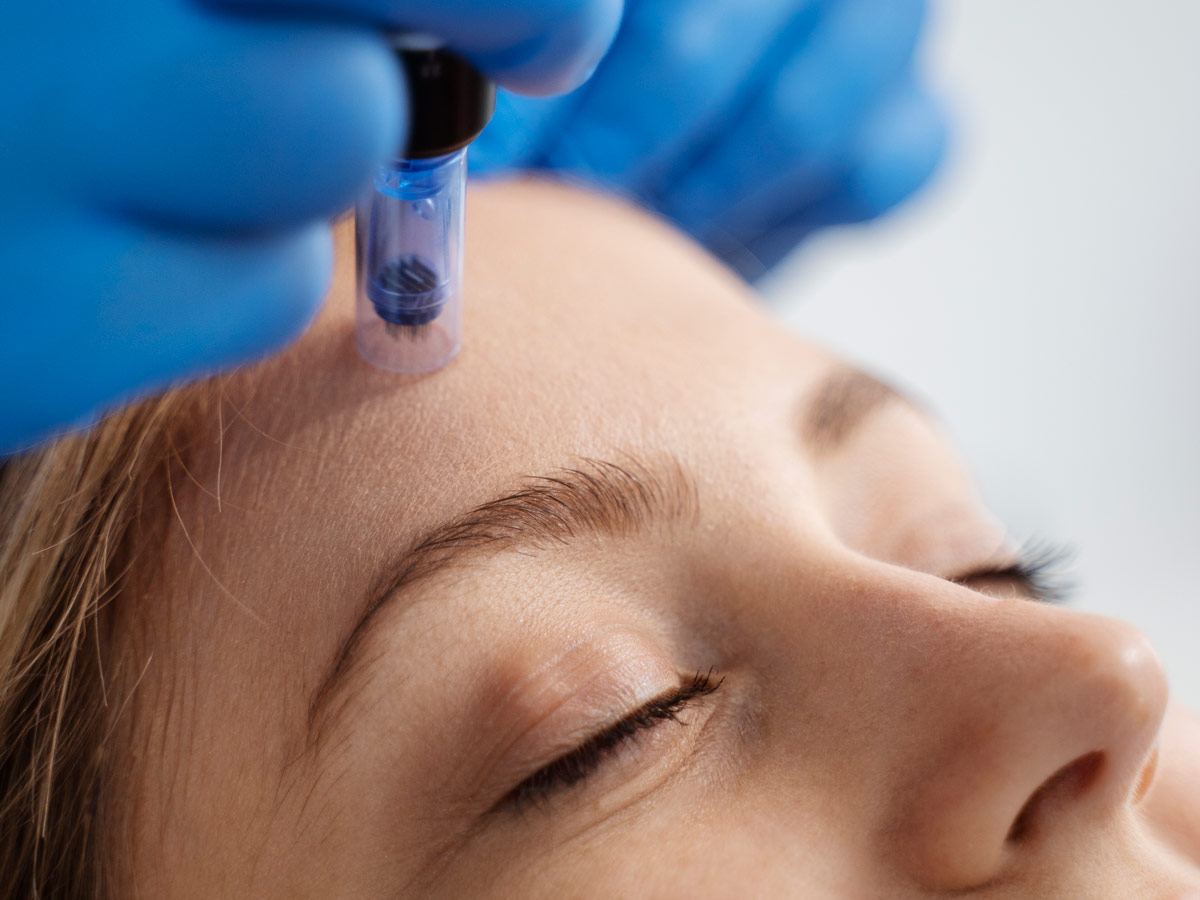 Exosomas faciales: qué son, cómo funcionan y qué resultados aportan realmente