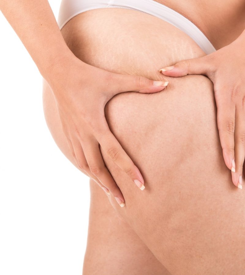 TightSculpting o remodelación corporal clínica Dra Elmira Tensado de cuello